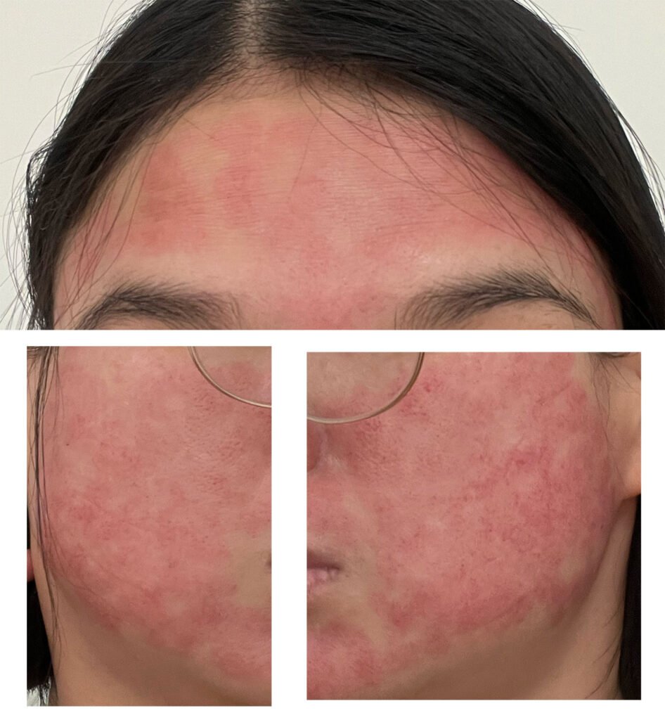 醫美術後保養：DOCTOB 試用心得2