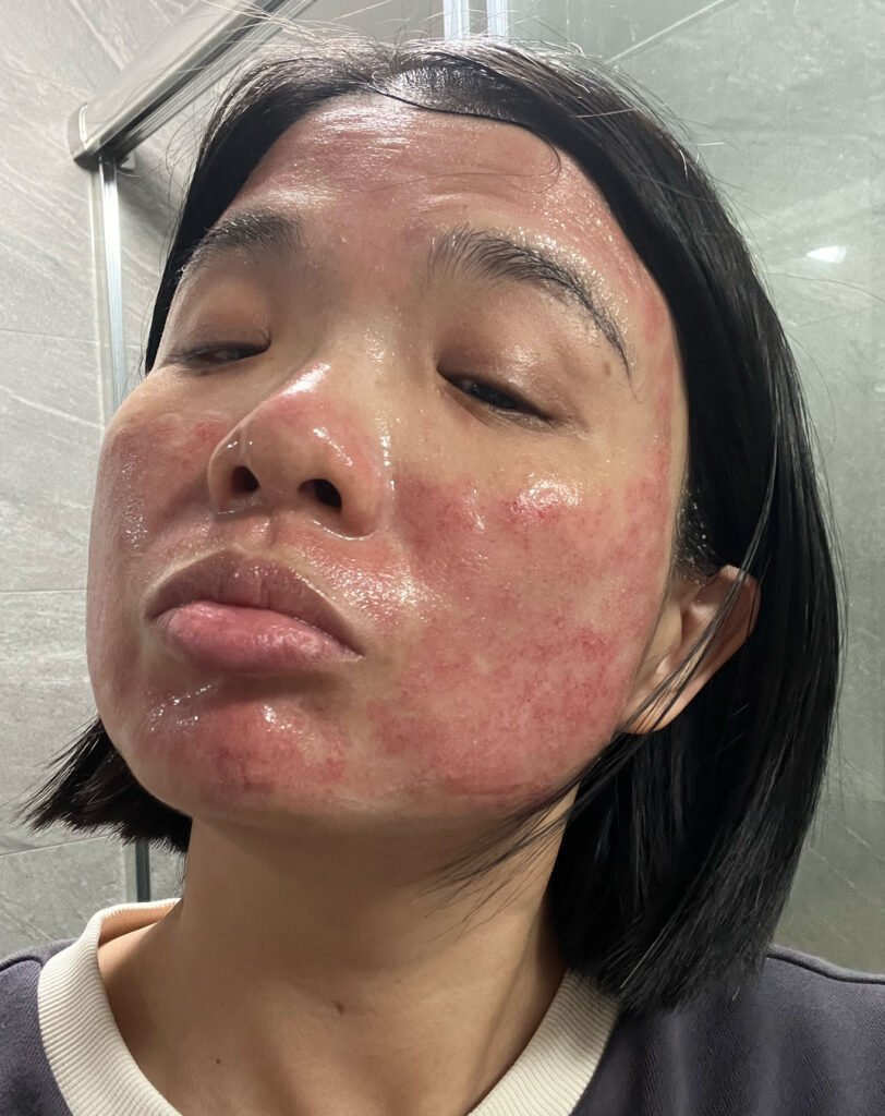 醫美術後保養：DOCTOB 試用心得4