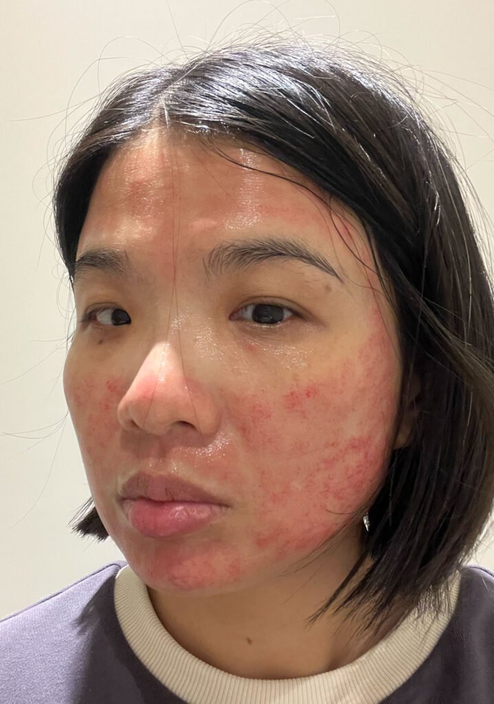 醫美術後保養：DOCTOB 試用心得5