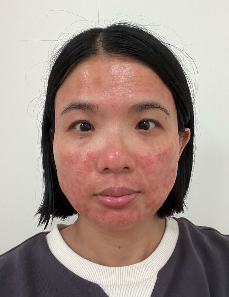 醫美術後保養：DOCTOB 試用心得7